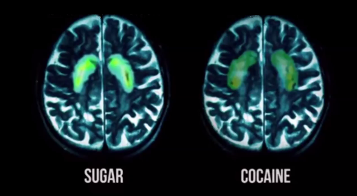 how to give up sugar - Sugar cocaine addiction addictive