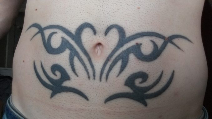 Laser Tattoo Removal - Before and After