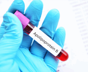 Apolipoprotein B blood test advanced lipids